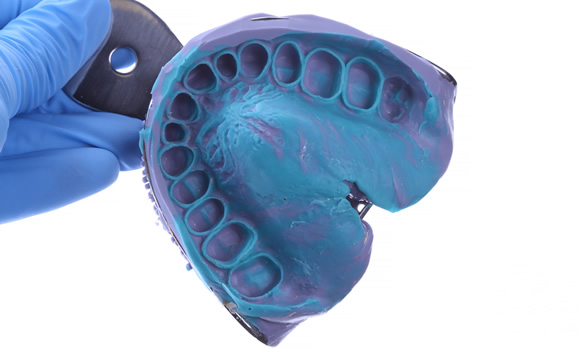 シリコーン印象材