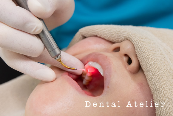 Er:YAGレーザー（エルビウムヤグレーザー）