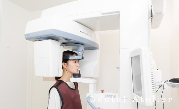 歯科ＣＴスキャン