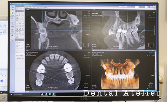 歯科ＣＴ画像