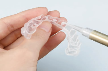 ホワイトニングジェル注入