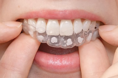 マウストレー装着