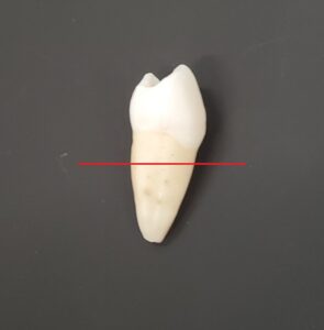 歯の構造　根管　根管治療　自由が丘　歯医者