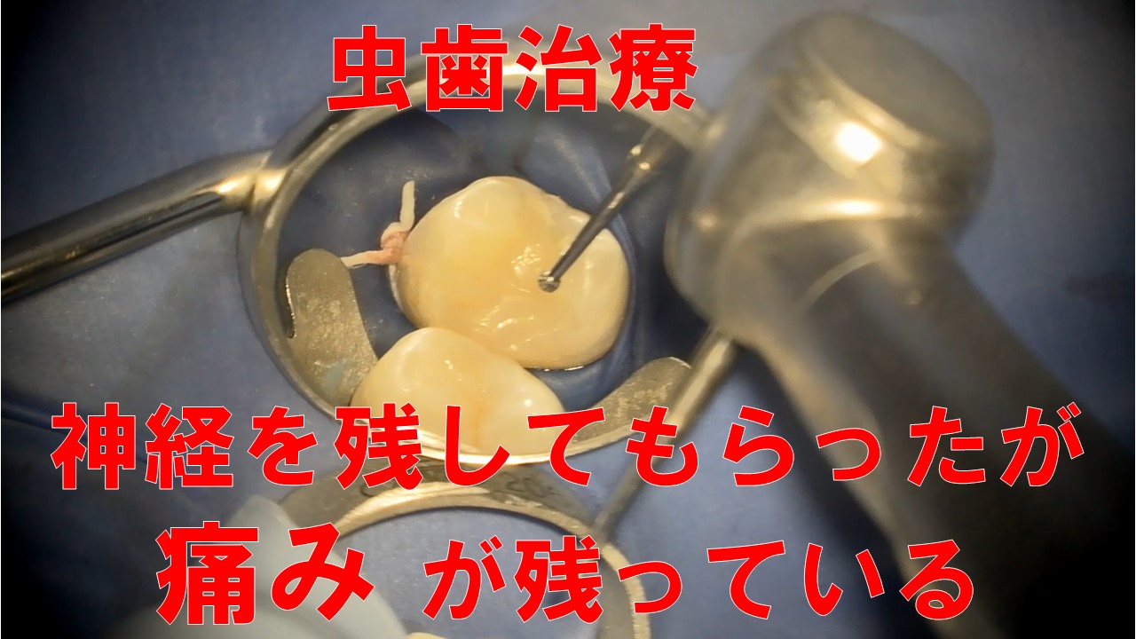 歯科臨床まずはここから! 欠損補綴: 卒後5年を支えるスタート