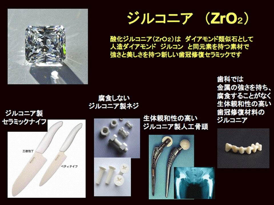 ジルコニア ジルコニアインレー ジルコニアクラウン フルジルコニア