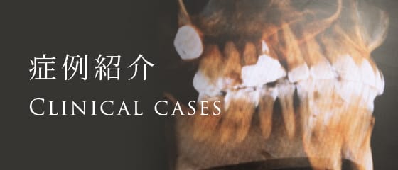 症例紹介
