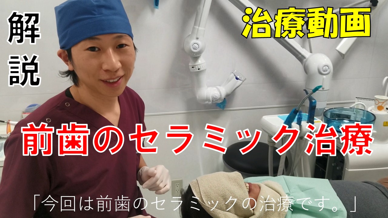 前歯セラミック治療