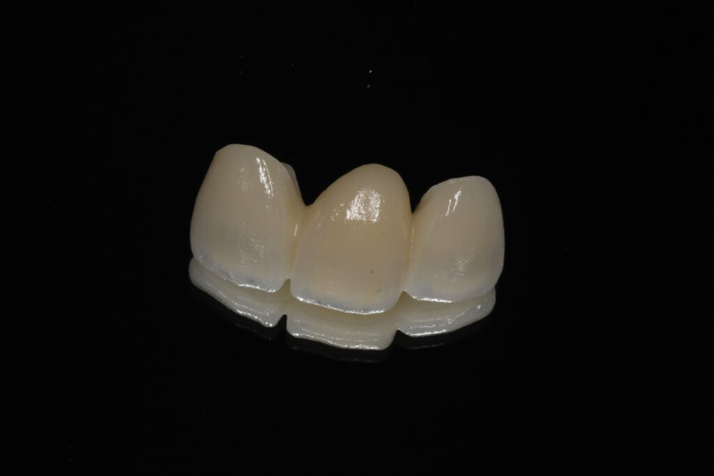 ジルコニア　セラミック　前歯　審美歯科　自由が丘　歯医者