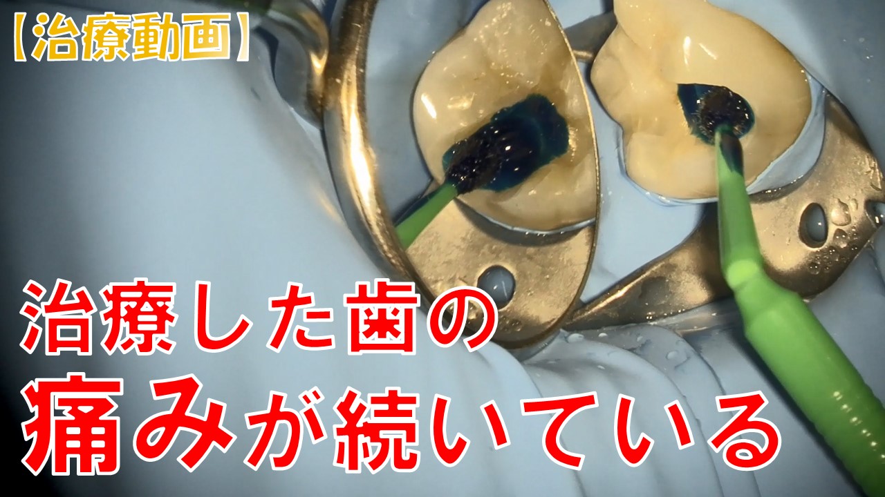 歯が痛い　虫歯治療後　歯医者
