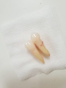 歯並び 矯正 歯医者 自由が丘