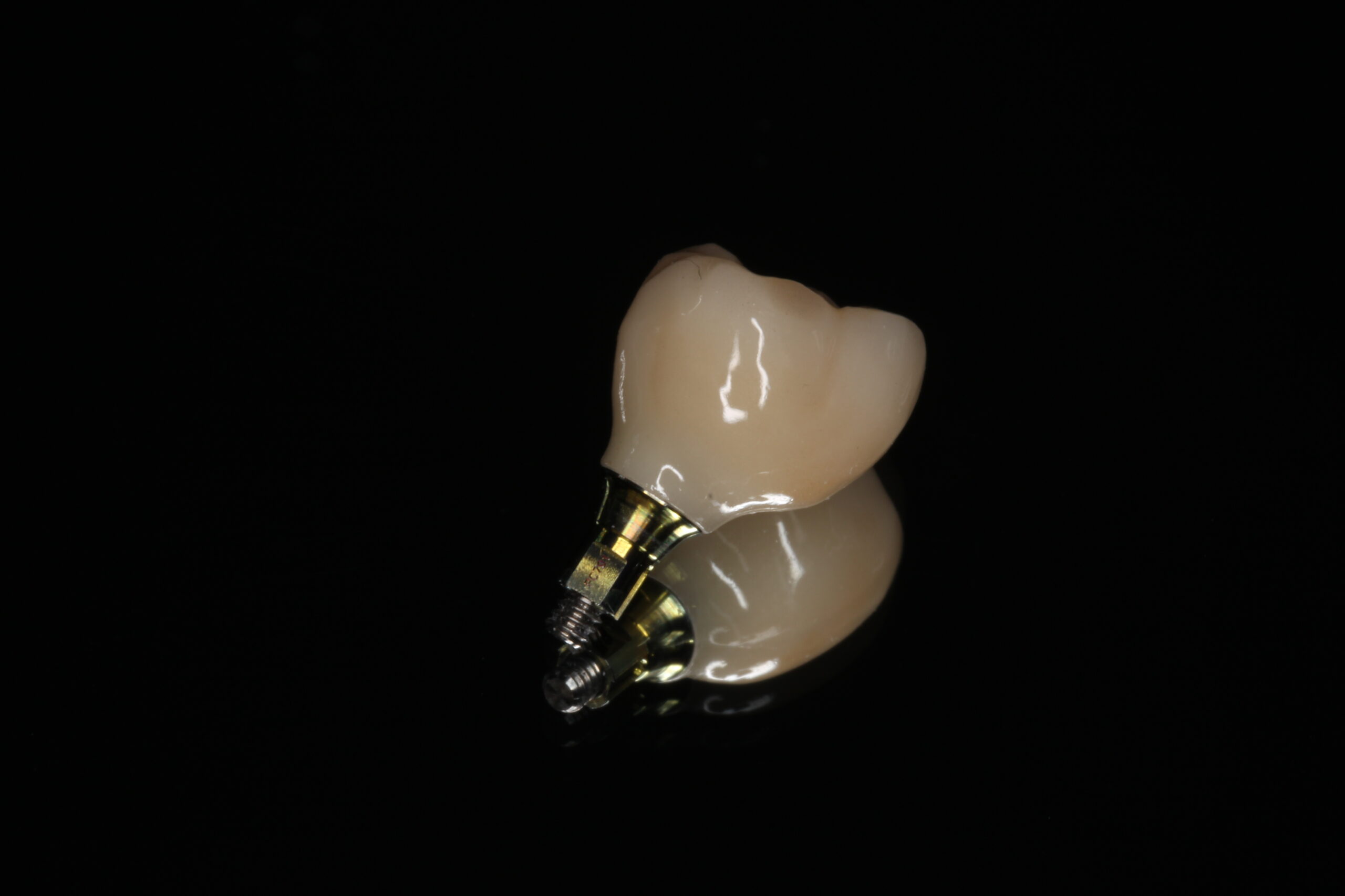 インプラント　自由が丘　歯医者　デンタルアトリエ