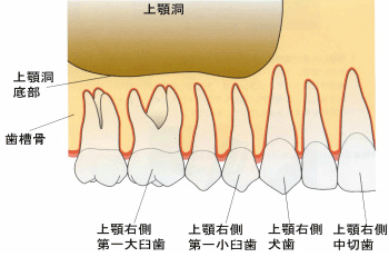 根管治療　マイクロエンド　自由が丘　歯医者　