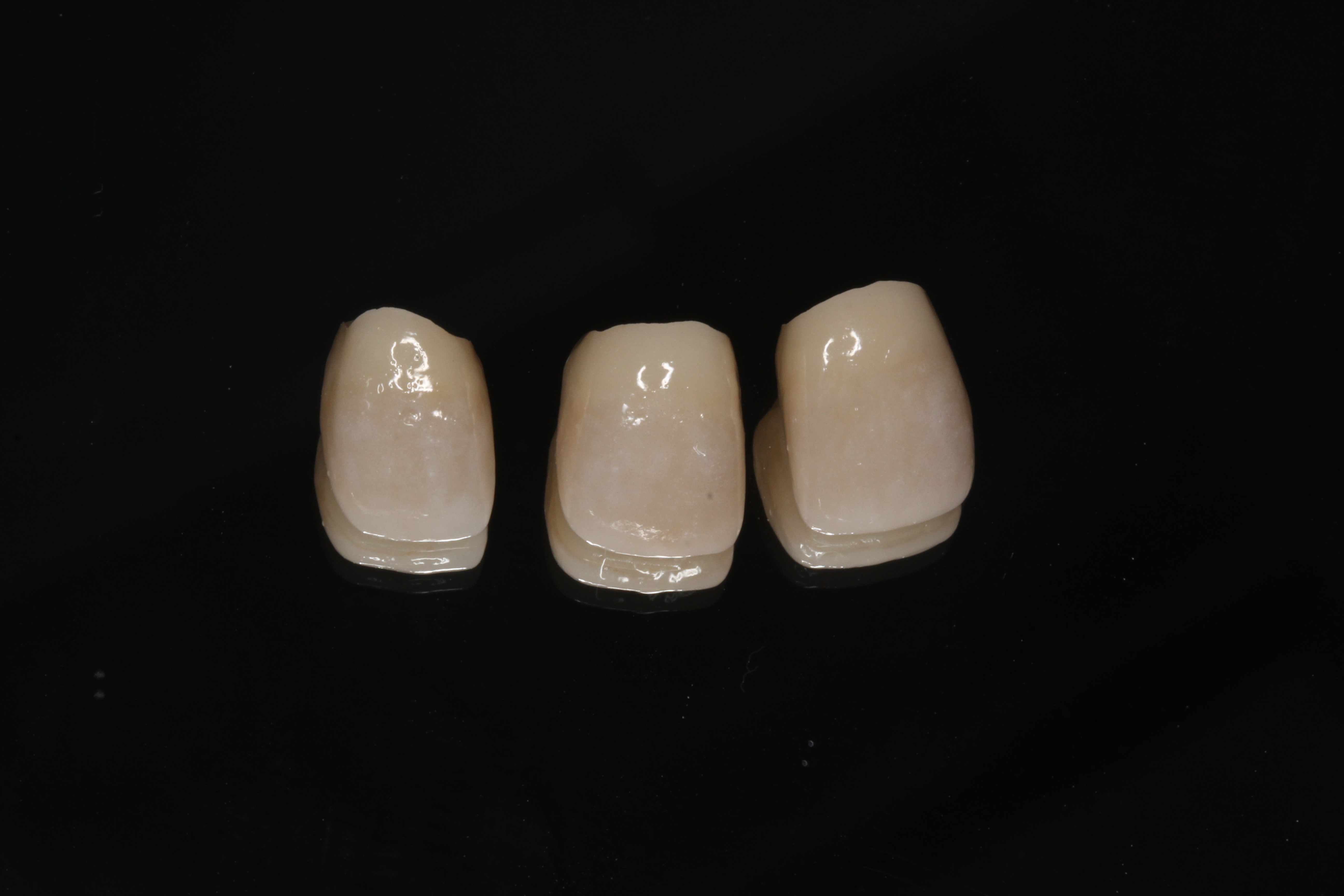 審美歯科 自由が丘 歯医者 セラミック