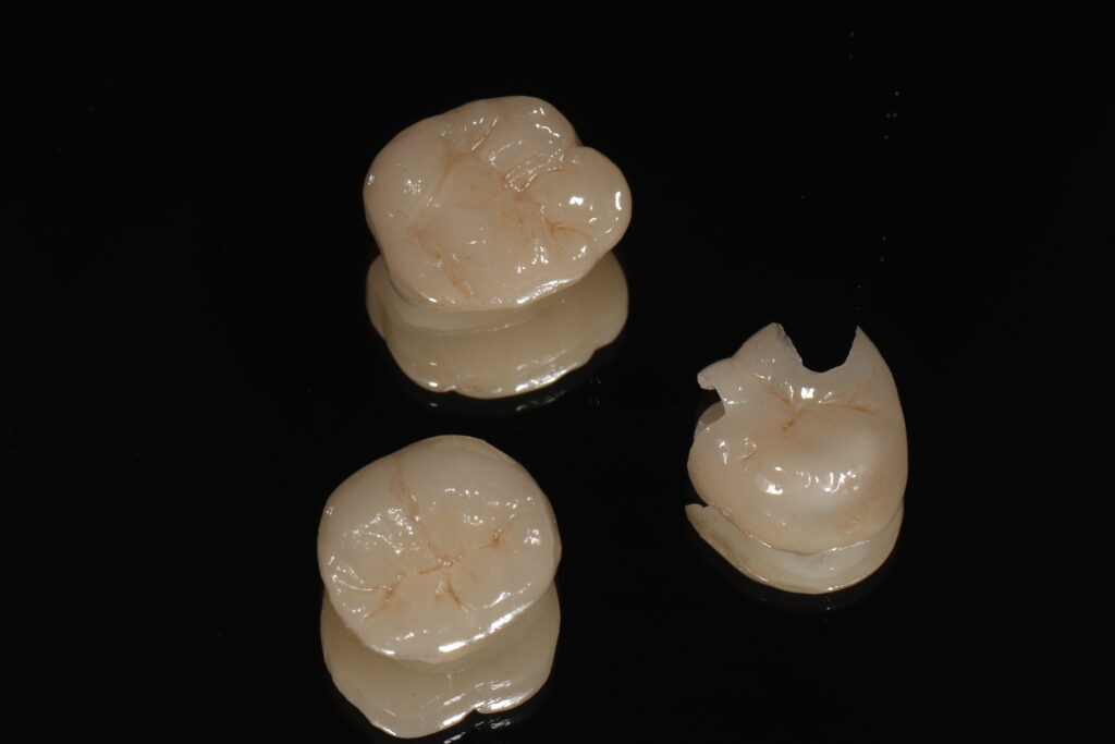 セラミック　ジルコニア　歯医者　自由が丘