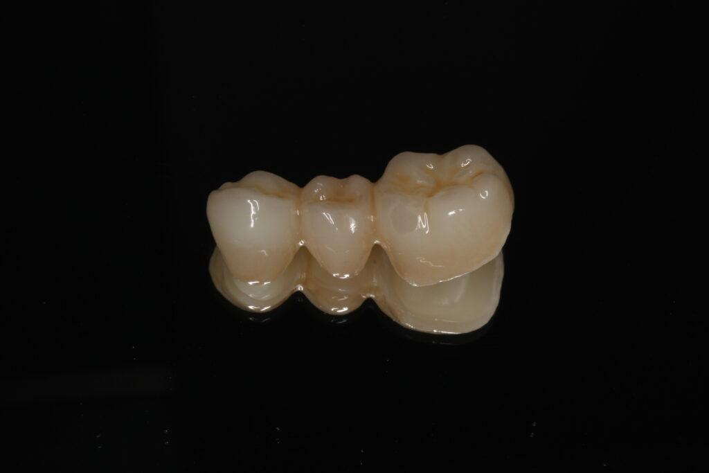 セラミックブリッジ